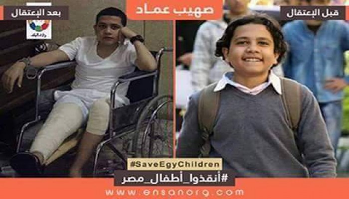 والدة الطفل "صهيب عماد" تطالب بانقاذ نجلها