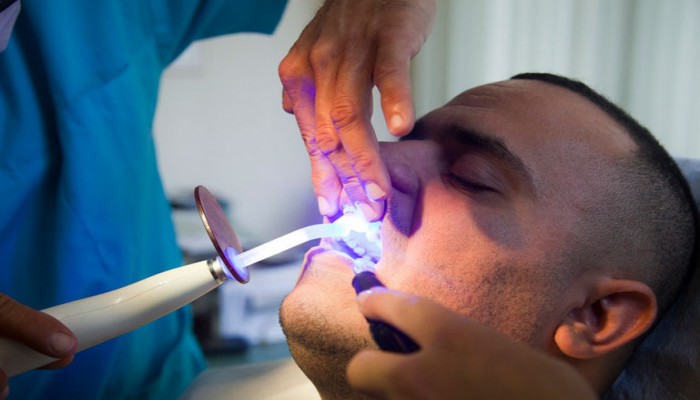 أربع وصفات منزلية مضرة وخادعة لتبييض الأسنان