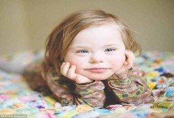 رزقت بطفل "داون" .. لا تحزن وأبشر بالخير كله