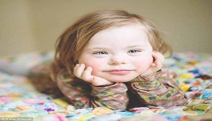 رزقت بطفل "داون" .. لا تحزن وأبشر بالخير كله