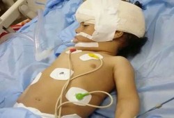 الشهاب : وفاة طفلة بسيناء متأثرة بإصابة من رصاص الجيش