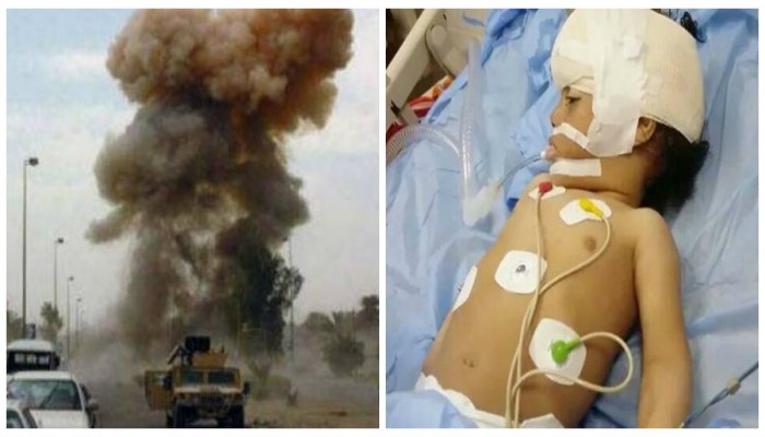 مسلحون يصيبون مجندَيْن بتفجير عبوة جنوب رفح..وقوات السيسي تقتل الأطفال