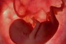 علماء يتوصلون إلى معرفة سبب تكرّر سقوط الجنين