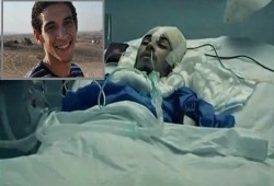 بعد 5 أعوام "غيبوبة" إفاقة "معوض عادل" أحد مصابي محمد محمود