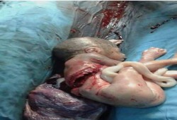 المتحدث باسم الإخوان عن جيش السيسي : صهاينة حتى النخاع !! ‫#‏قتلوا_الجنين‬