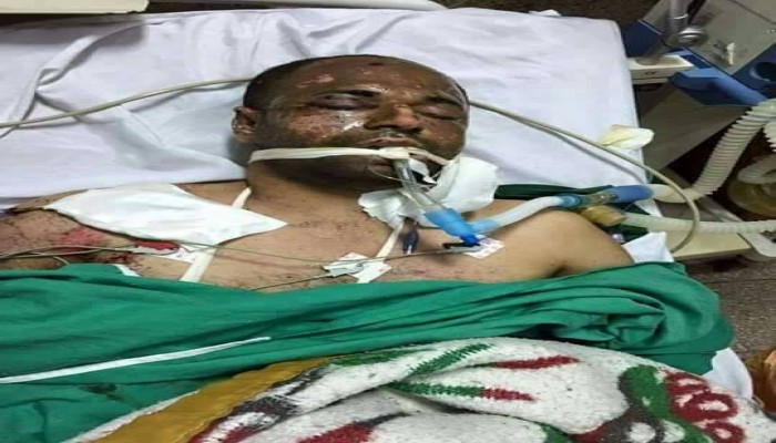 بالصور .. مركز الشهاب :احمد نصر عبيد يعاني من تعمد اهمال علاجه