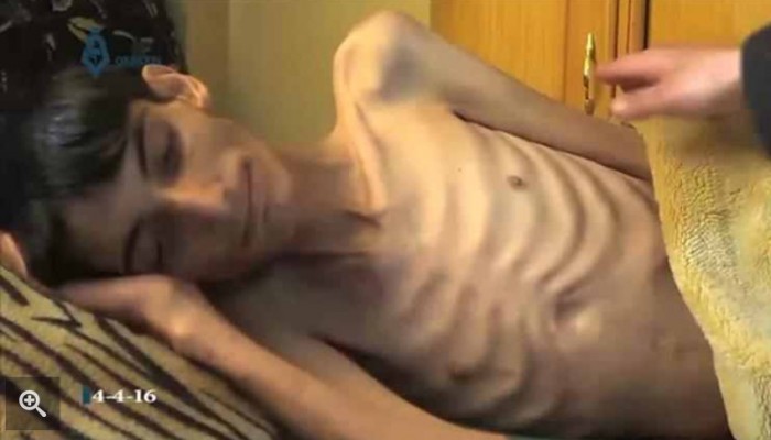 مطالب أممية بإجلاء المرضى والجرحى المحاصرين بسوريا