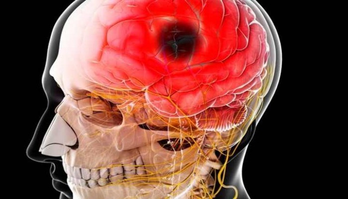 علماء يبدأون رحلة الوصول لعلاج الزهايمر وسكتات الدماغ