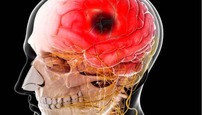 علماء يبدأون رحلة الوصول لعلاج الزهايمر وسكتات الدماغ