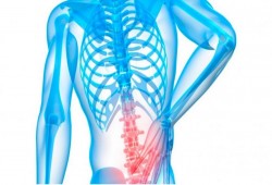 نصائح لتجنب الإصابة بالانزلاق الغضروفي