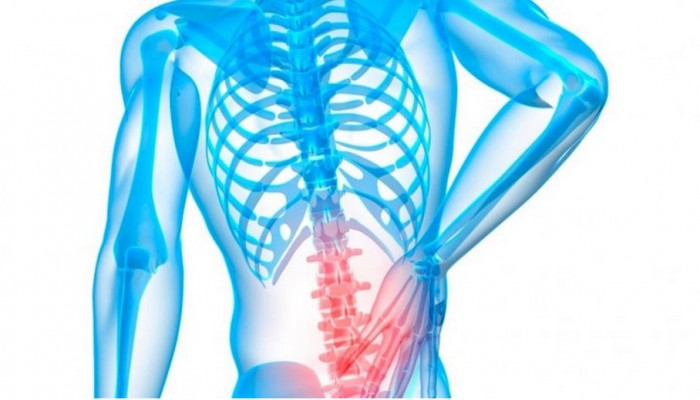 نصائح لتجنب الإصابة بالانزلاق الغضروفي