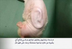 إنتاج أول أذن بشرية من خلايا جذعية مستحثة