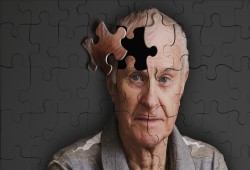 قريبًا.. علاج الزهايمر بحقن البروتين