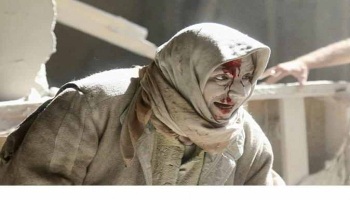 #حلب_تشتعل.. مشاهد مبكية لما يفعله الأسد في الشعب السوري (صور)