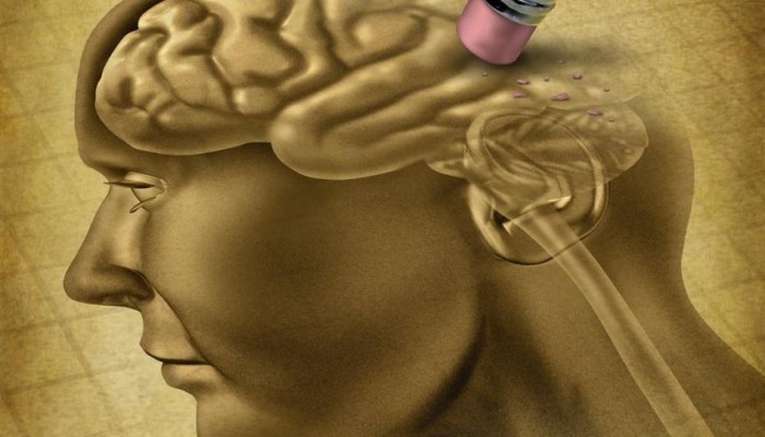 نتائج مذهلة في دواء شائع للسكري يوقف الزهايمر