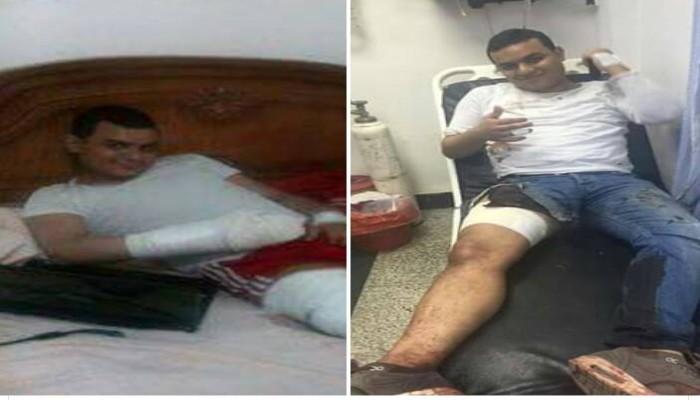 الإسكندرية.. عصابة الميكروباص تواصل إجرامها في ظل انشغال الأمن بمطاردة رافضى الانقلاب