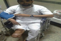 المعتقل "أحمد نصر" يدخل في إضراب عن الطعام بعد تعفن جروحه ورفض إستكمال علاجة