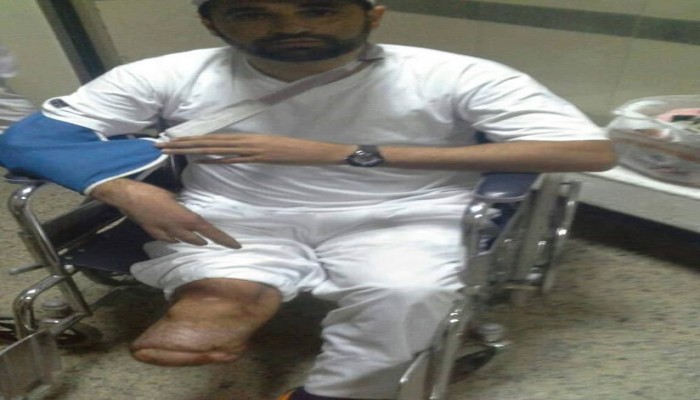 المعتقل "أحمد نصر" يدخل في إضراب عن الطعام بعد تعفن جروحه ورفض إستكمال علاجة