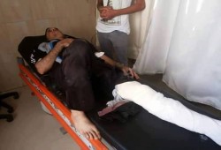 أمين شرطة يطلق النار على ابن عمه بالبحيرة بسبب "ربع قيراط"