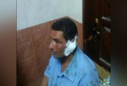 أمين شرطة يقضم أذن عامل كهرباء ببورسعيد