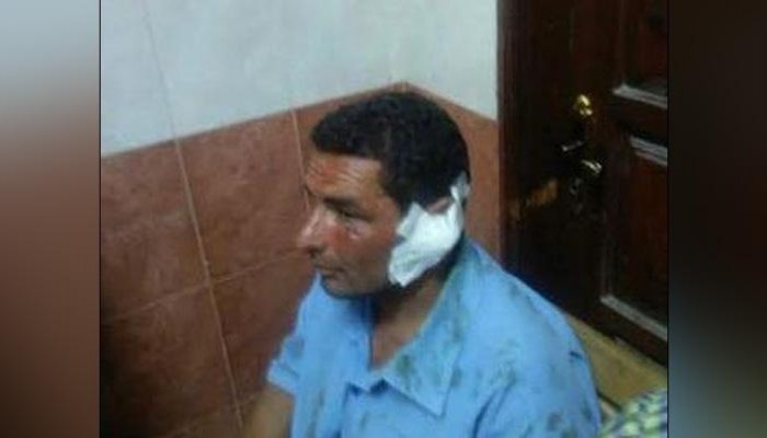 أمين شرطة يقضم أذن عامل كهرباء ببورسعيد