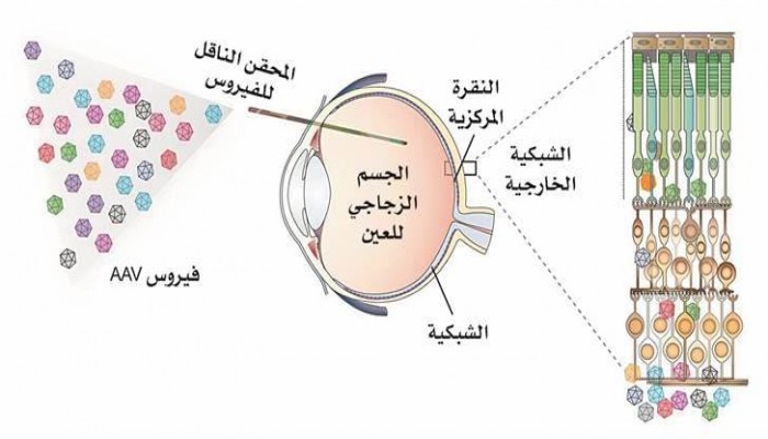 "الحقن الفيروسي".. أمل جديد يتشبس به "فاقدو البصر"