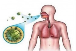 الصحة العالمية: خطة علاجية لمقاومة سلالات جديدة من السل أشد خطورة