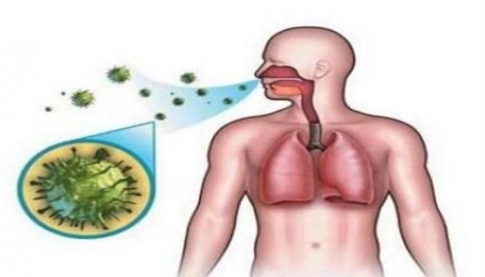 الصحة العالمية: خطة علاجية لمقاومة سلالات جديدة من السل أشد خطورة