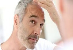 إليكى سيدتى: 3 طرق طبيعية للتخلصمن الشعر الأبيض