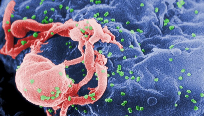 الولايات المتحدة .. قلق كبير بعد ظهور عدوى ببكتيريا لا تتأثر بكافة المضادات الحيوية