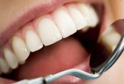 أشهر 10 معتقدات خاطئة عن العناية بالأسنان