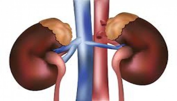 5 نصائح لمرض الكُلى في شهر رمضان