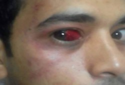 تعذيب "أحمد غنيم" المتحدث بإسم طلاب ضد الانقلاب