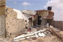 فتاه تفقد بصرها بعد قصف جيش السيسي لمنزل بسيناء