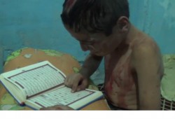 فيديو مؤثر.. طفل سوري مصاب يقرأ القرآن بعد فقدان والديه