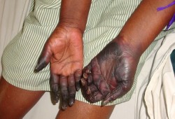 تعرف على كارثة القمح الملوث الذي استورده نظام السيسي لمصر