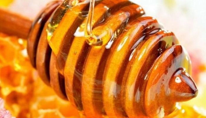 منها العسل وخل التفاح.. 4 وصفات منزلية بسيطة لعلاج آثار الحروق