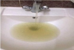 أهالى قرية بالبحيرة يتعرّضون للأمراض بعد تلوث مياه الشرب