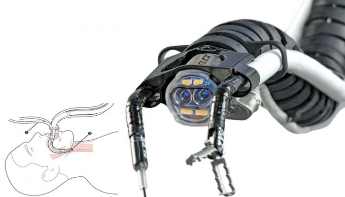 "ثعبان" آلي لإجراء عمليات جراحية في المناطق الحرجة