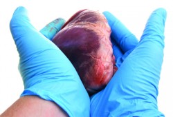 دراسة: القاهرة أكبر سوق لتجارة الأعضاء البشرية في أفريقيا