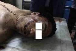 والد "أحمد مدحت" يكشف بالمستندات كيف تم تعذيب ابنه حتى الموت؟