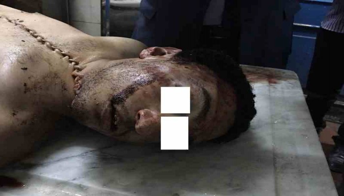 والد "أحمد مدحت" يكشف بالمستندات كيف تم تعذيب ابنه حتى الموت؟