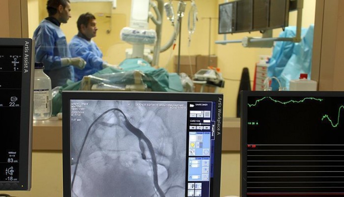 مسكنات شائعة ترتبط بزيادة خطر الإصابة بقصورالقلب (دراسة)
