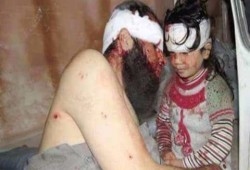 "بوتين" يجدد غاراته الدموية.. 24 شهيدا وتدمير رابع مستشفى بحلب