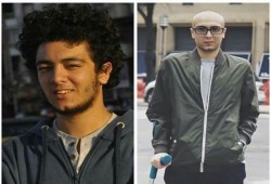 سبب اندهاش الأطباء الأمريكيين المعالجين للشهيد "مهند"