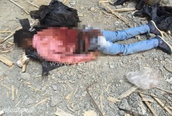 إسقاط طالب من الدور الثالث وكسر جمجمته بالأمن الوطني