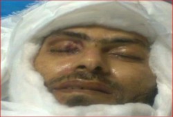 صورة الشهيد "أشرف القزاز" تظهر آثار التعذيب على وجهه
