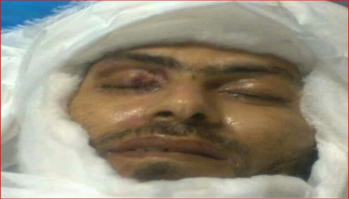 صورة الشهيد "أشرف القزاز" تظهر آثار التعذيب على وجهه