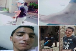 داخلية الانقلاب ترحل "أحمد جمعة" من مستشفي كفر الدوار لسجن الابعادية رغم مرضه