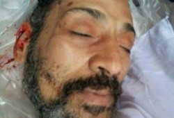 تقرير الطب الشرعي يؤكد وفاة "مجدي مكين" نتيجة التعذيب